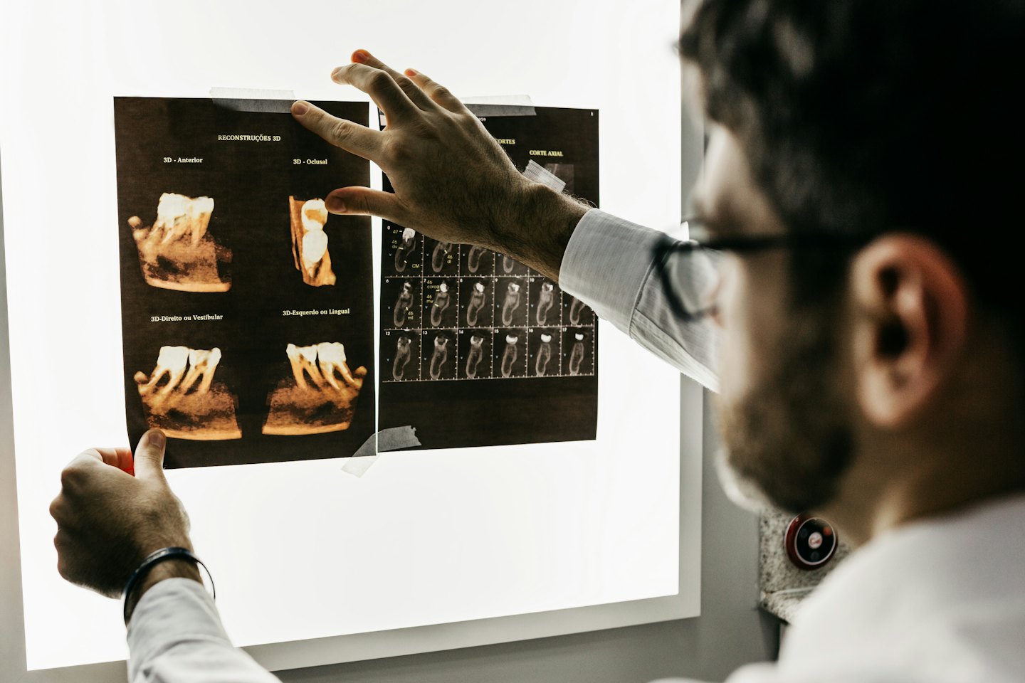Dentista revisando radiografías dentales en 3D en una mesa de luz.